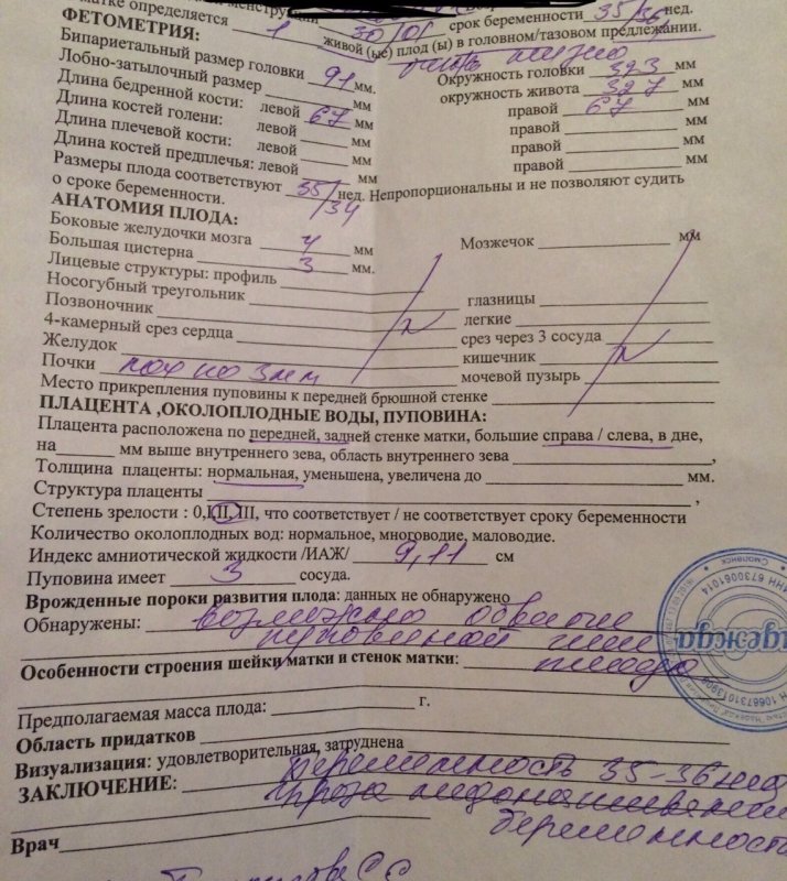 УЗИ 35 недель беременности норма таблица