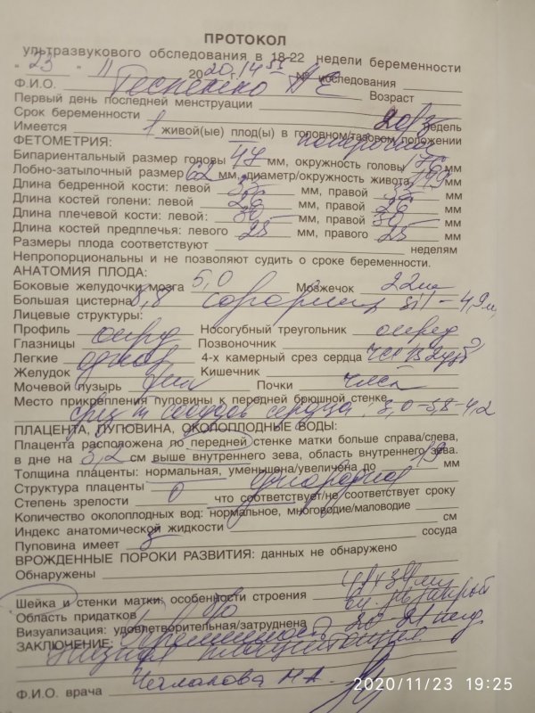 Доплер УЗИ при беременности нормы